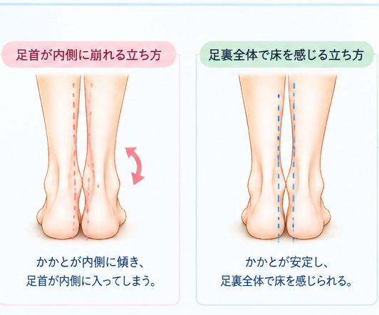 足首が内側に崩れる立ち方と、足裏全体で床を感じる立ち方の比較